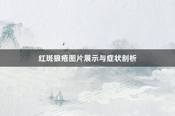 红斑狼疮图片展示与症状剖析